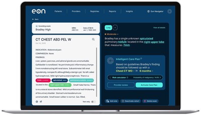 Sarasota Memorial Cancer Team Achieves 75% Early-Stage Lung Cancer Diagnosis Rate by Expanding Detection Beyond Screening